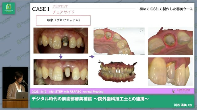 デジタル時代の前歯部審美補綴　〜院外歯科技工士との連携〜│川谷 温美先生