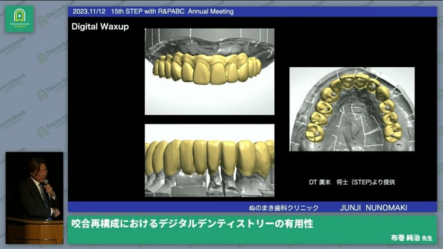 咬合再構成におけるデジタルデンティストリーの有用性│布巻 純治先生