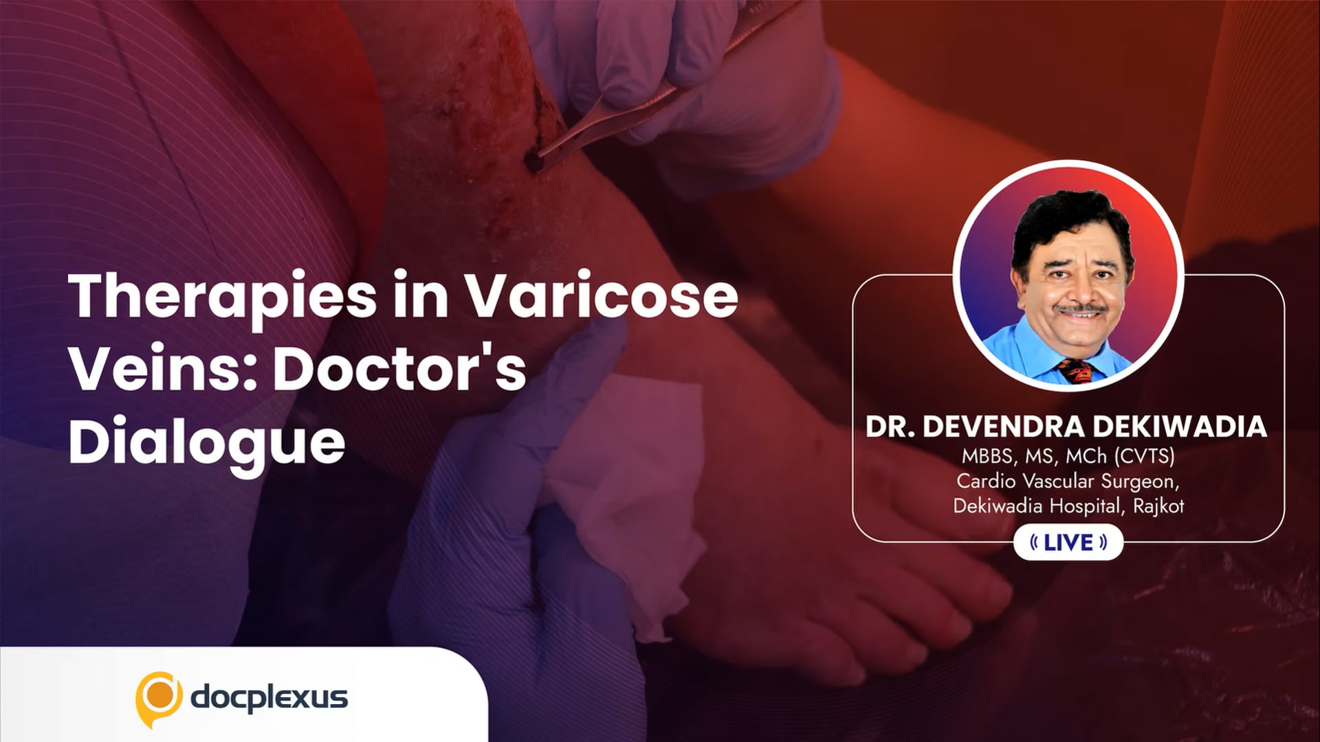 Therapies in Varicose Veins: Doctor’s Dialogue