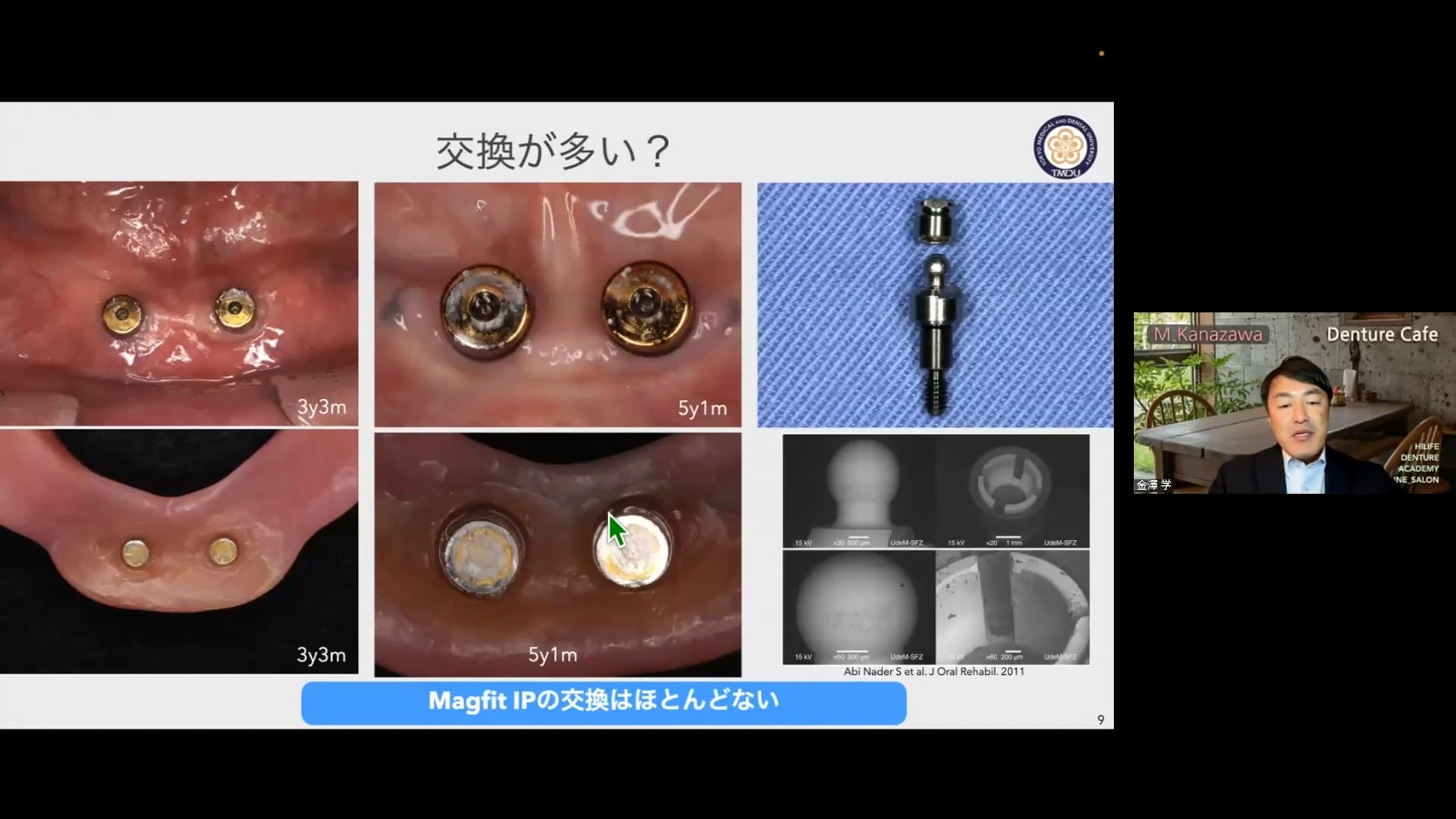 磁性アタッチメントについて┃金澤 学先生