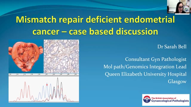 MMR deficient endometrial carcinoma - A case-based discussion, Dr Sarah Bell