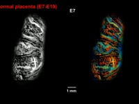 Newswise:Video Embedded a-window-into-placental-development-during-pregnancy