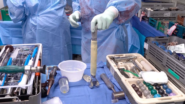 Salvage Total Femur Replacement for Prosthetic Joint Infection