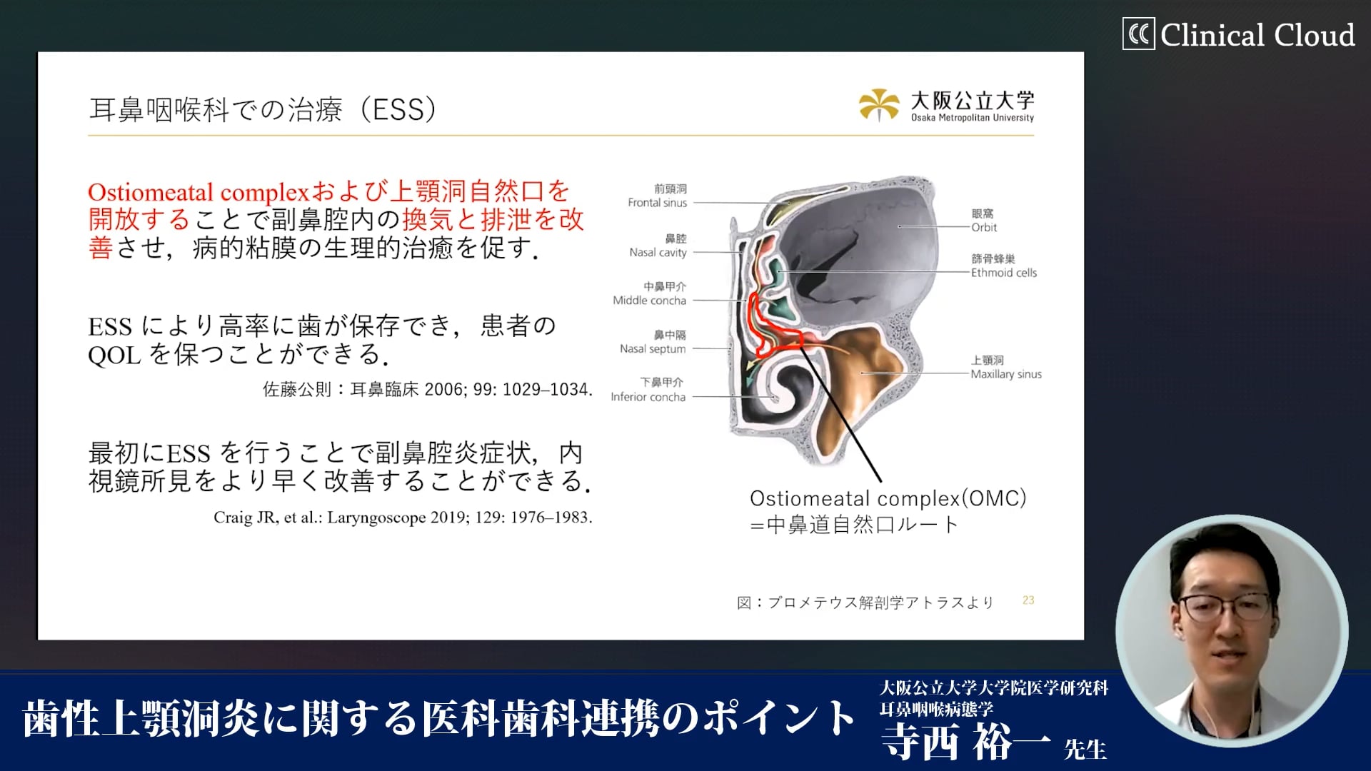 歯性上顎洞炎に関する医科歯科連携のポイント #2