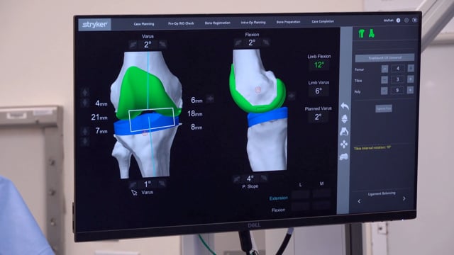 Robotic-assisted Restricted Kinematic Press-fit TKA: Utilizing CPAK Classification