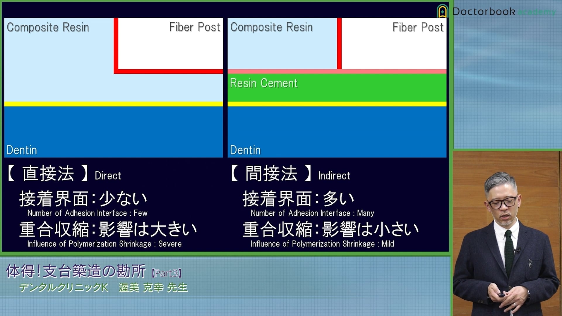 臨床知見録_支台築造_支台築造における直接法・間接法の違い