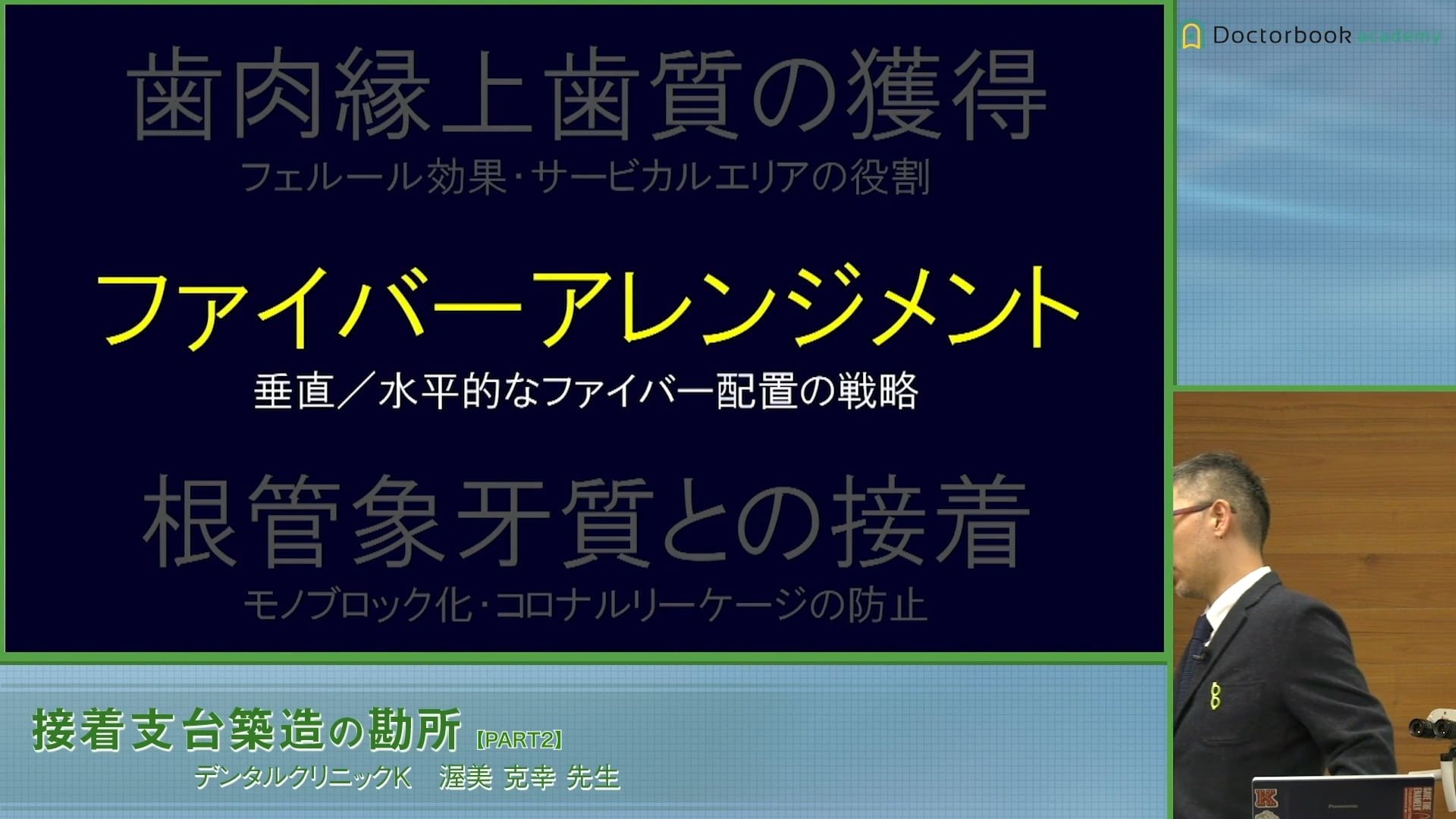 臨床知見録_支台築造_ファイバーアレンジメントについて