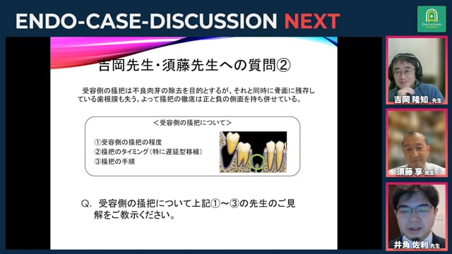 自家歯牙移植に伴う根管治療 / 受容側の掻爬 / 移植治療の流れ｜吉岡隆知先生・須藤享先生・井角佐利先生_#1