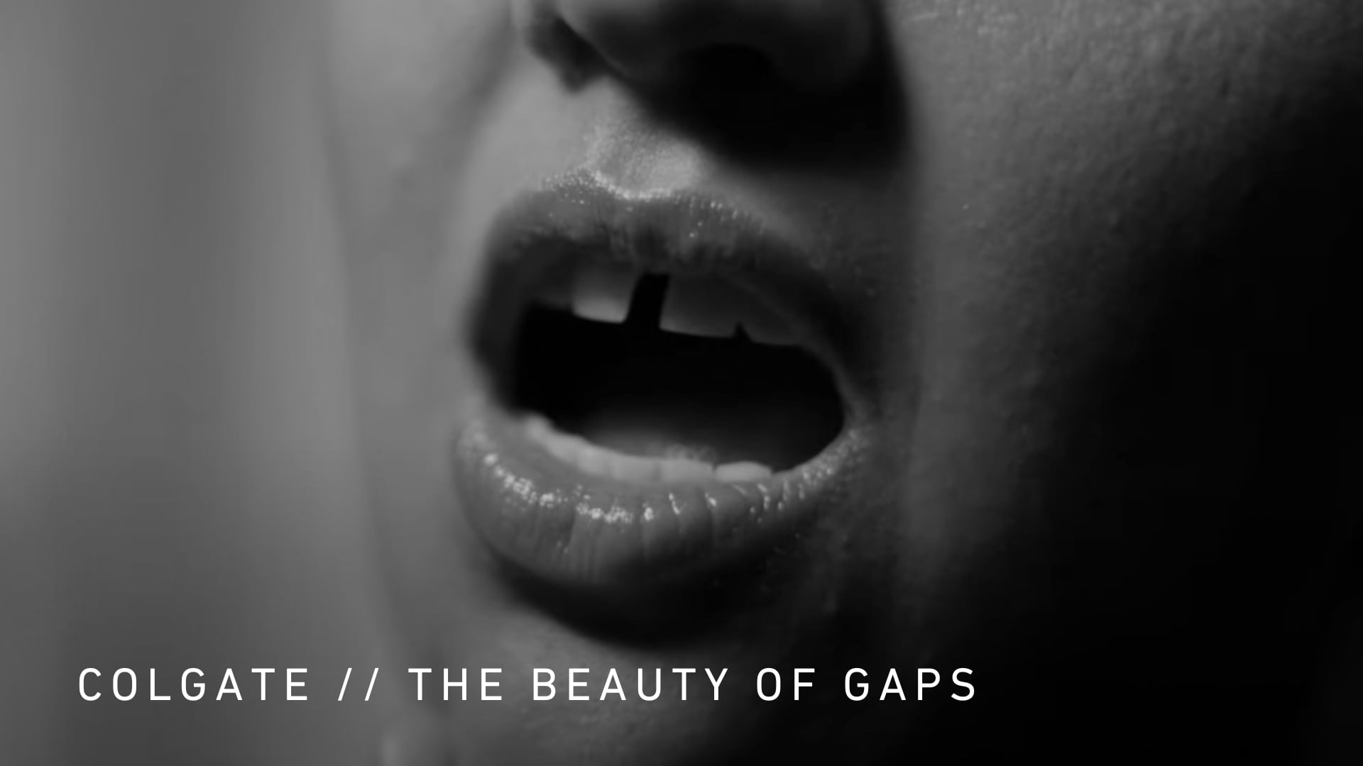 GAPS