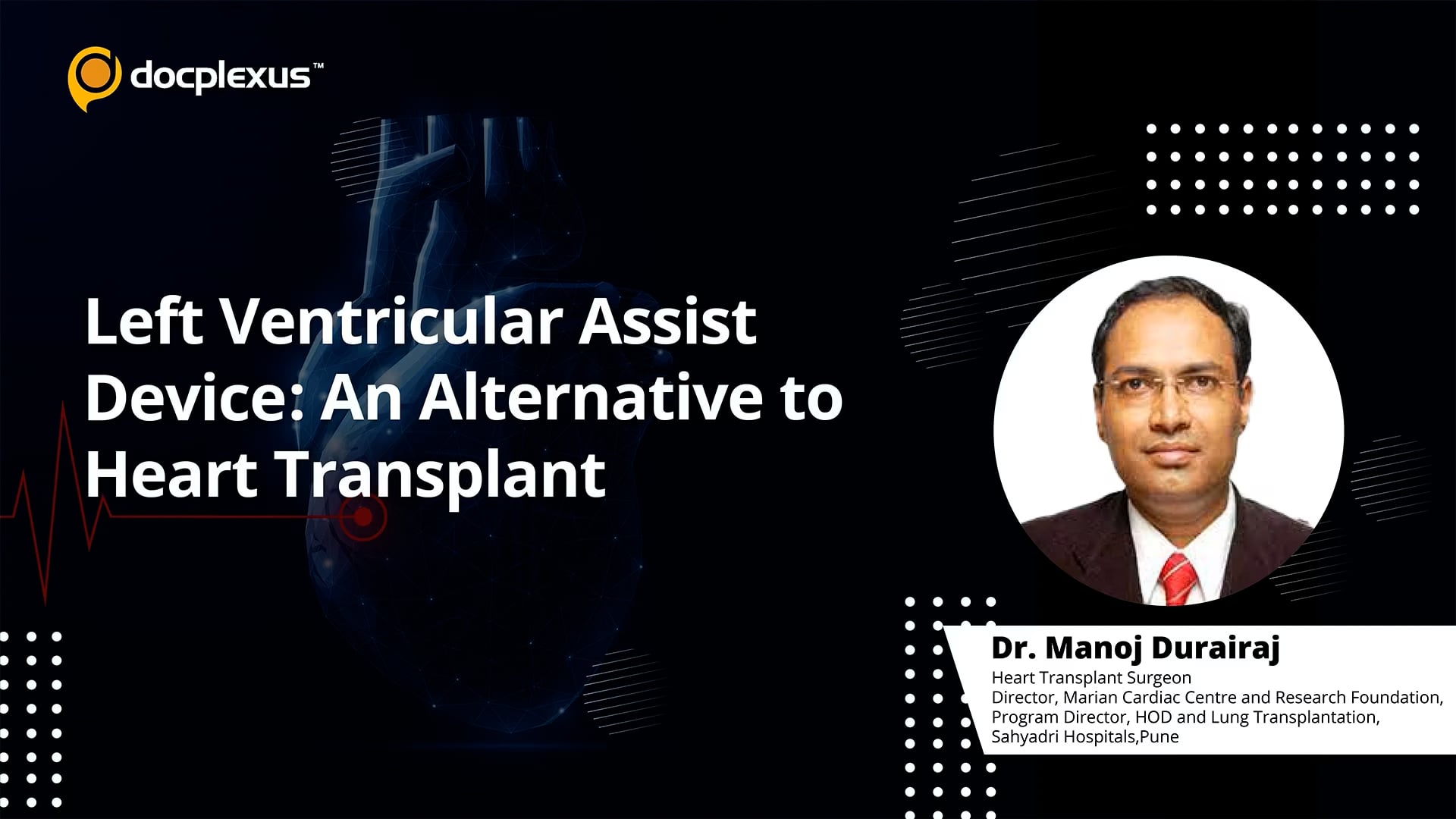 Left Ventricular Assist Device: An Alternative to Heart Transplant