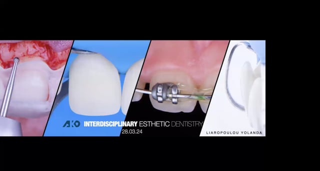 Interdisciplinary esthetic dentistry.