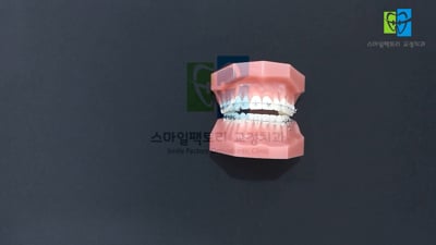 1. 시술, 뷰티 영..