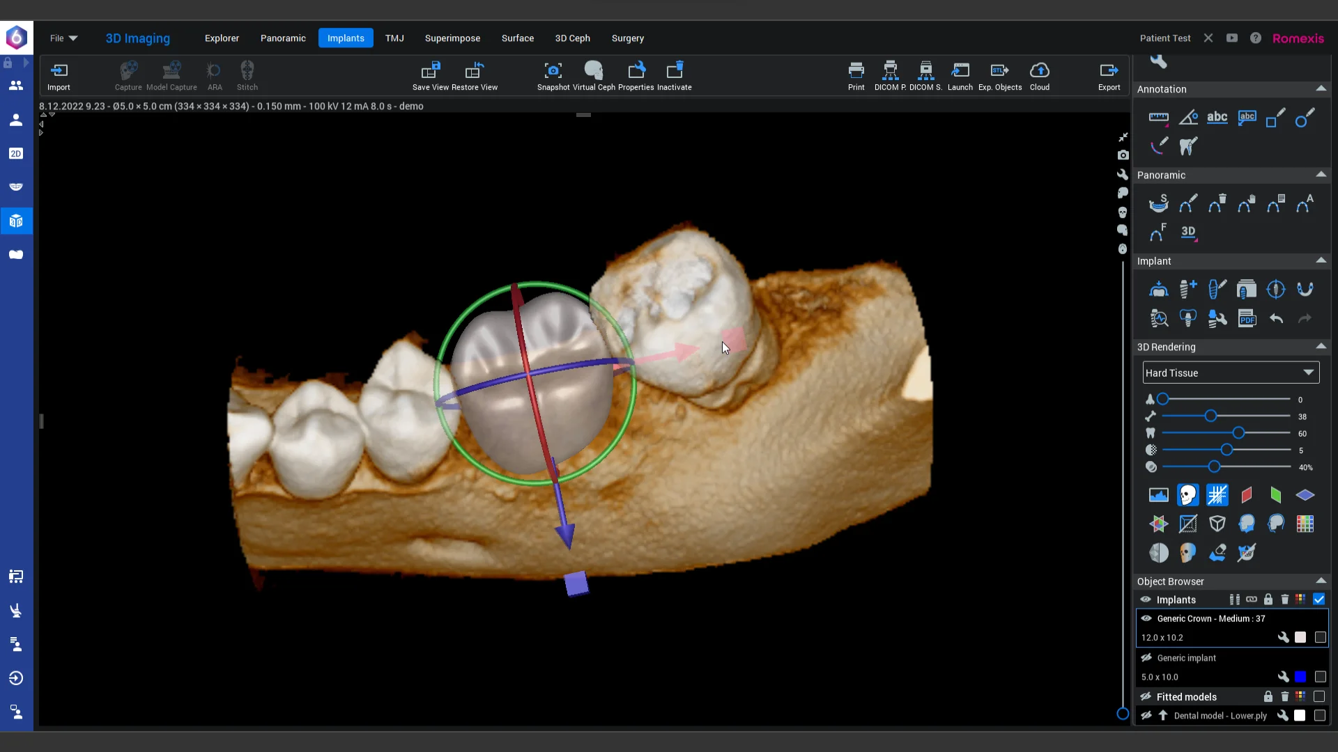 How to Use and adjust generic crown in Planmeca Romexis