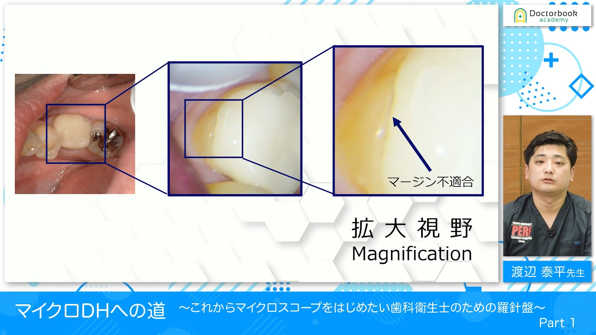 マイクロスコープの概要 拡大・照明 #1【プレミアム公開中】