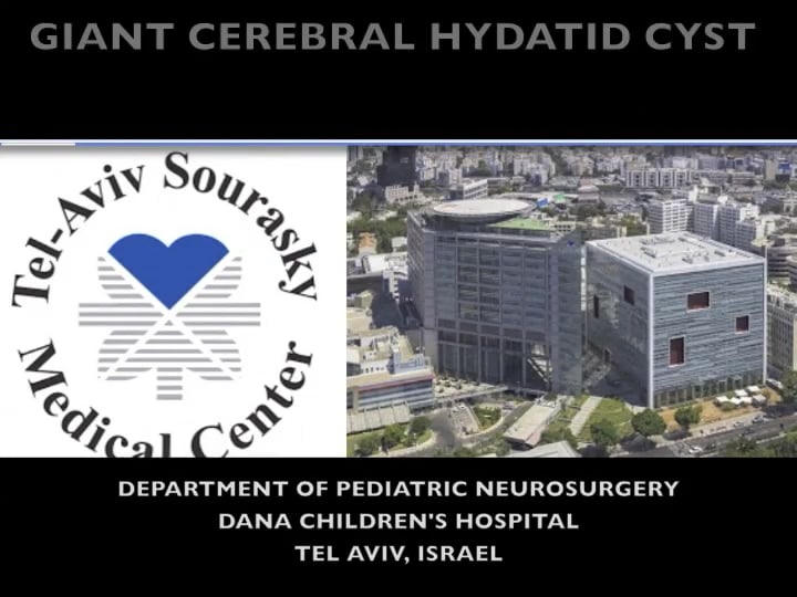Remuval Supratentorial of Hydatid Cyst