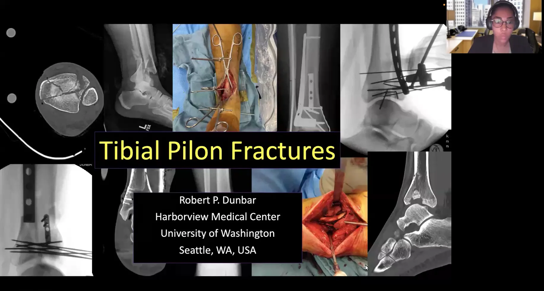 Complex Pilon Fractures - Dr Robert Dunbar | Haitian Orthopedic Grand ...