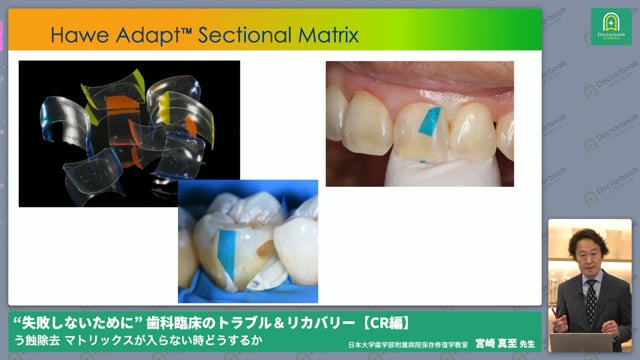  [保存修復]マトリックスが入らない時どうするか