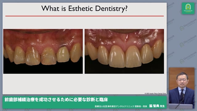 前歯部補綴治療を成功させるために必要な診断と臨床 | Doctorbook academy (ドクターブックアカデミー)