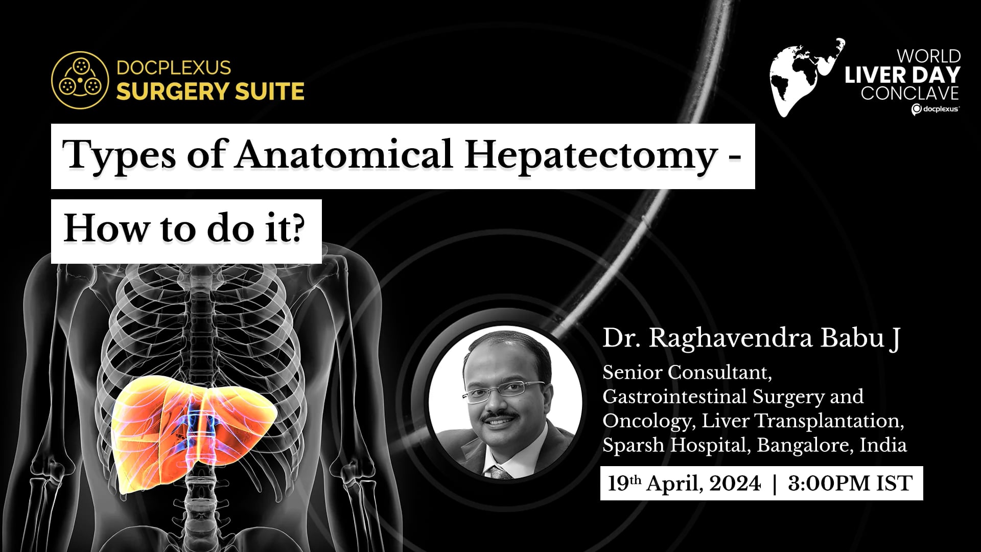 Types of Anatomical Hepatectomy – How to do it?