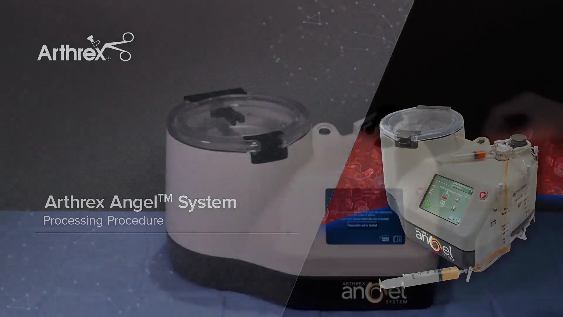 Angel Set-Up on Vimeo