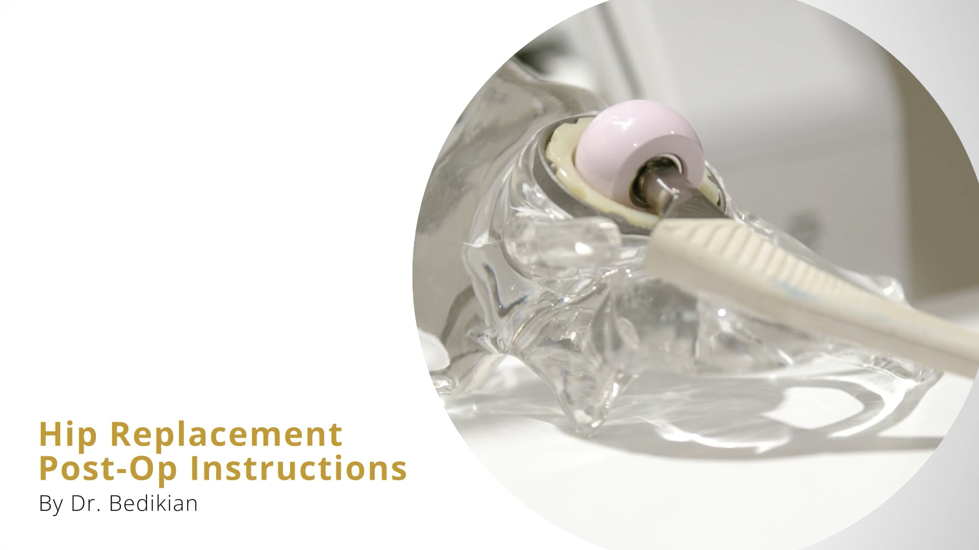 Hip Replacement Post-Op Instructions by Dr Bedikian