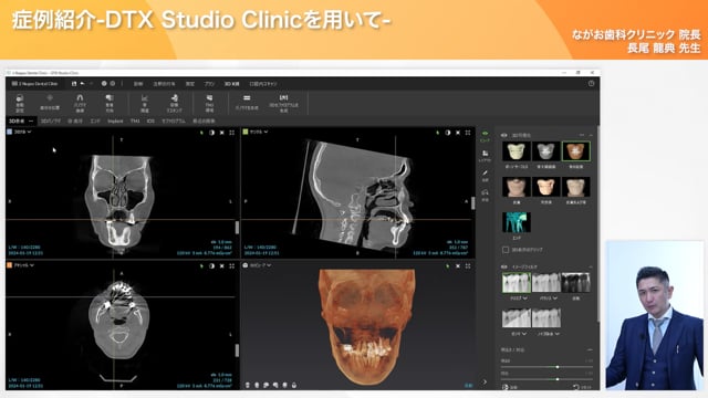 長尾龍典先生によるDTXを活用した症例紹介