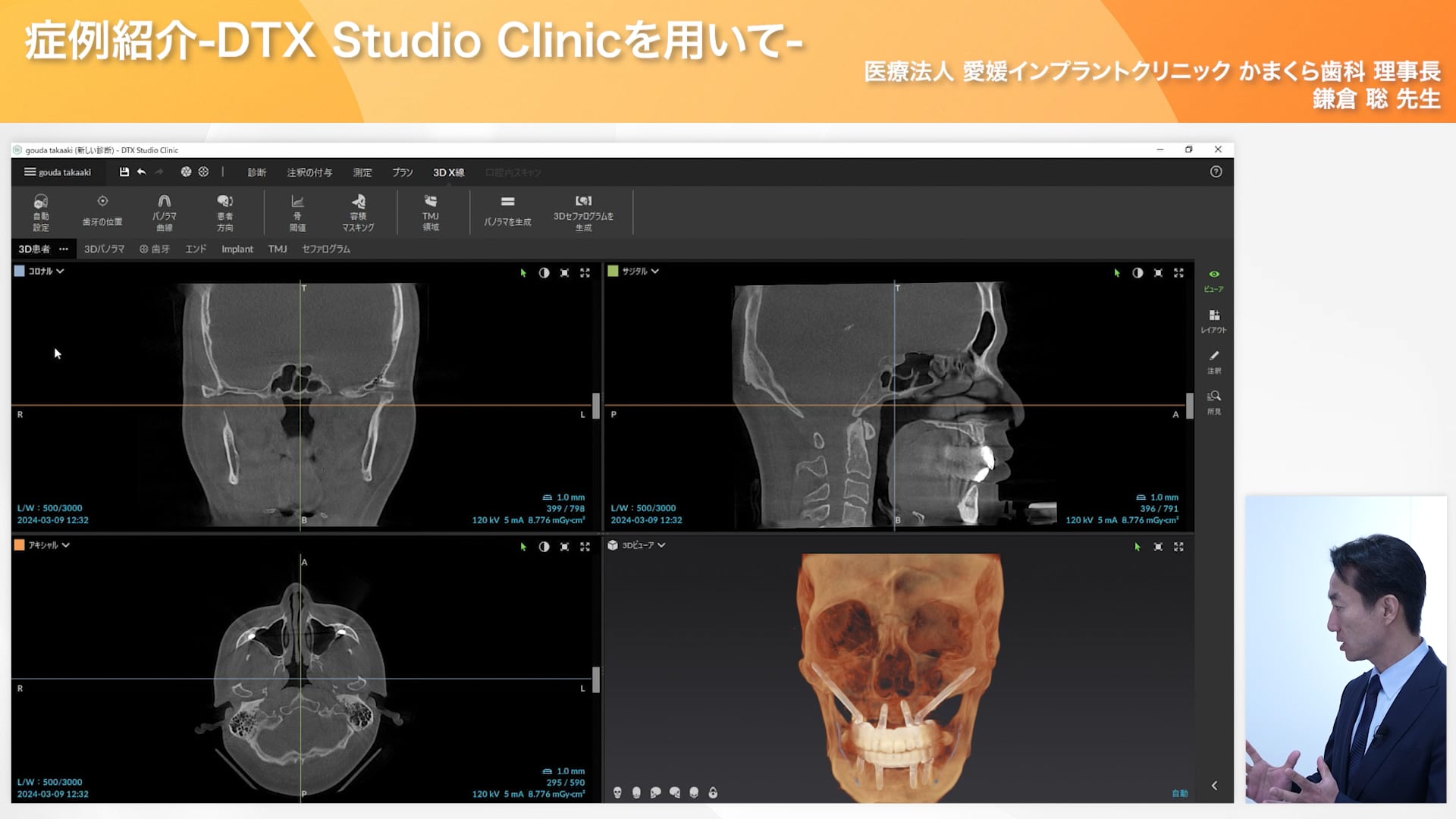 鎌倉聡先生によるDTXを活用した症例紹介