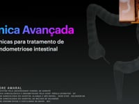 01 Técnicas para tratamento de endometriose intestinal - Alexandre Amaral