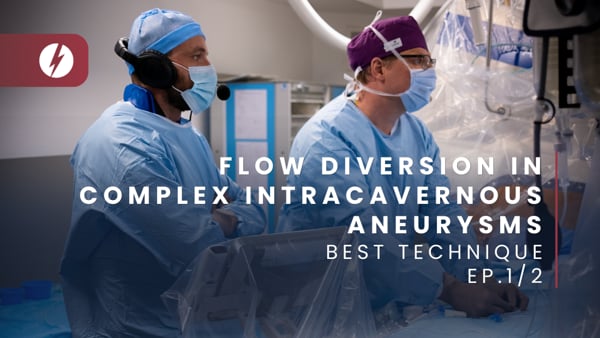 Flow diversion in complex intracavernous aneurysms - Ep.1/2