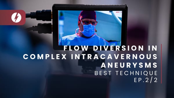 Flow diversion in complex intracavernous aneurysms - Ep.2/2