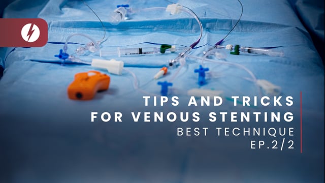 Tips and tricks for venous stenting - Ep.2/2