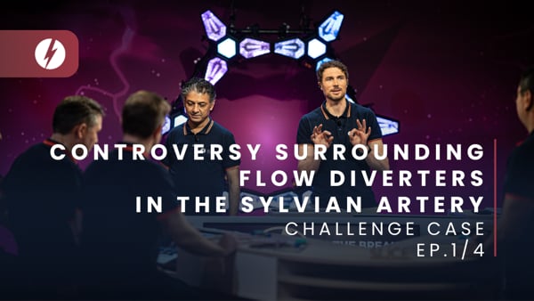 Controversy surrounding flow diverters in the sylvian artery - Ep.1/4