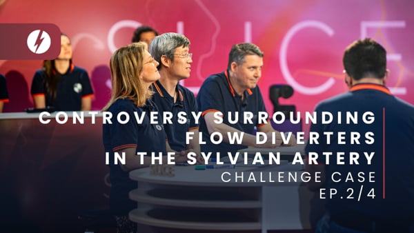 Controversy surrounding flow diverters in the sylvian artery - Ep.2/4