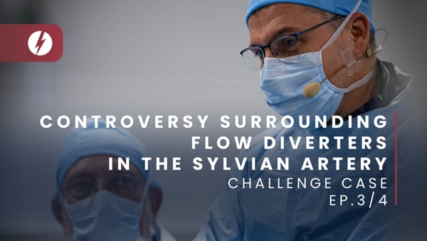 Controversy surrounding flow diverters in the sylvian artery - Ep.3/4