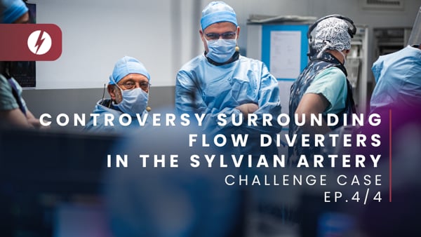 Controversy surrounding flow diverters in the sylvian artery - Ep.4/4