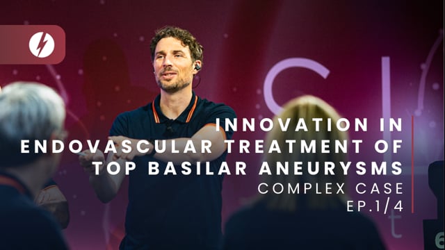 Innovation in endovascular treatment of top basilar aneurysms - Ep.1/4