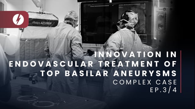 Innovation in endovascular treatment of top basilar aneurysms - Ep.3/4