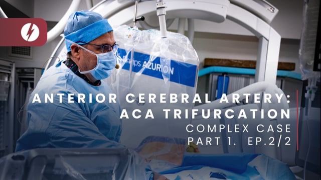 Anterior Cerebral Artery: ACA trifurcation - Ep.2/2