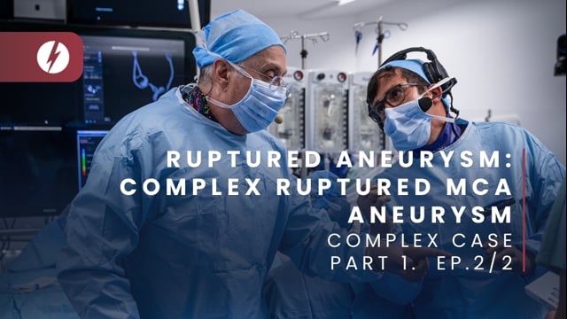 Ruptured aneurysm: Complex ruptured MCA aneurysm - Ep.2/2