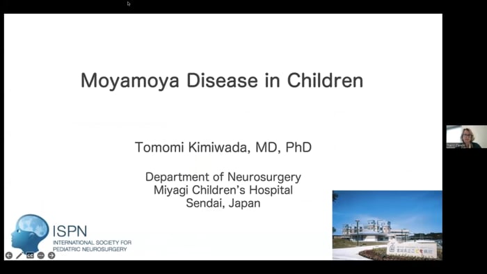 Moyamoya Disease in Children