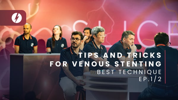 Tips and tricks for venous stenting - Ep.1/2
