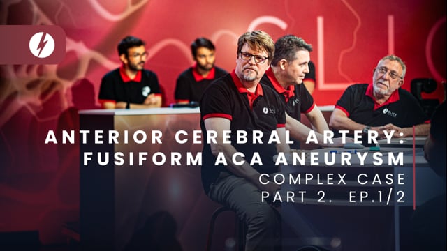 Anterior Cerebral Artery: Fusiform ACA aneurysm - Ep.1/2