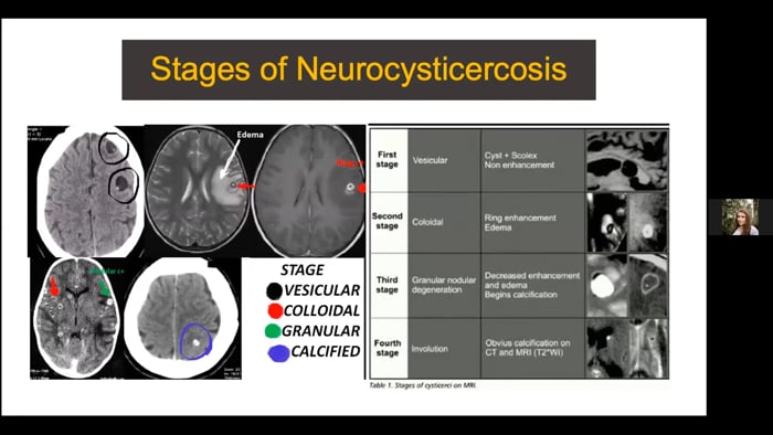 Neurocysticercosis