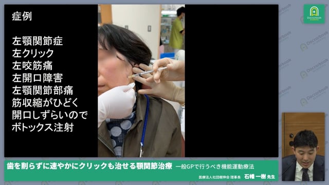 顎関節症を治療するための診断方法と運動療法のやり方｜歯を削らずに速やかにクリックも治せる顎関節治療 - 一般GPで行うべき機能運動療法 #1【09/19-09/25 プレミアム化】