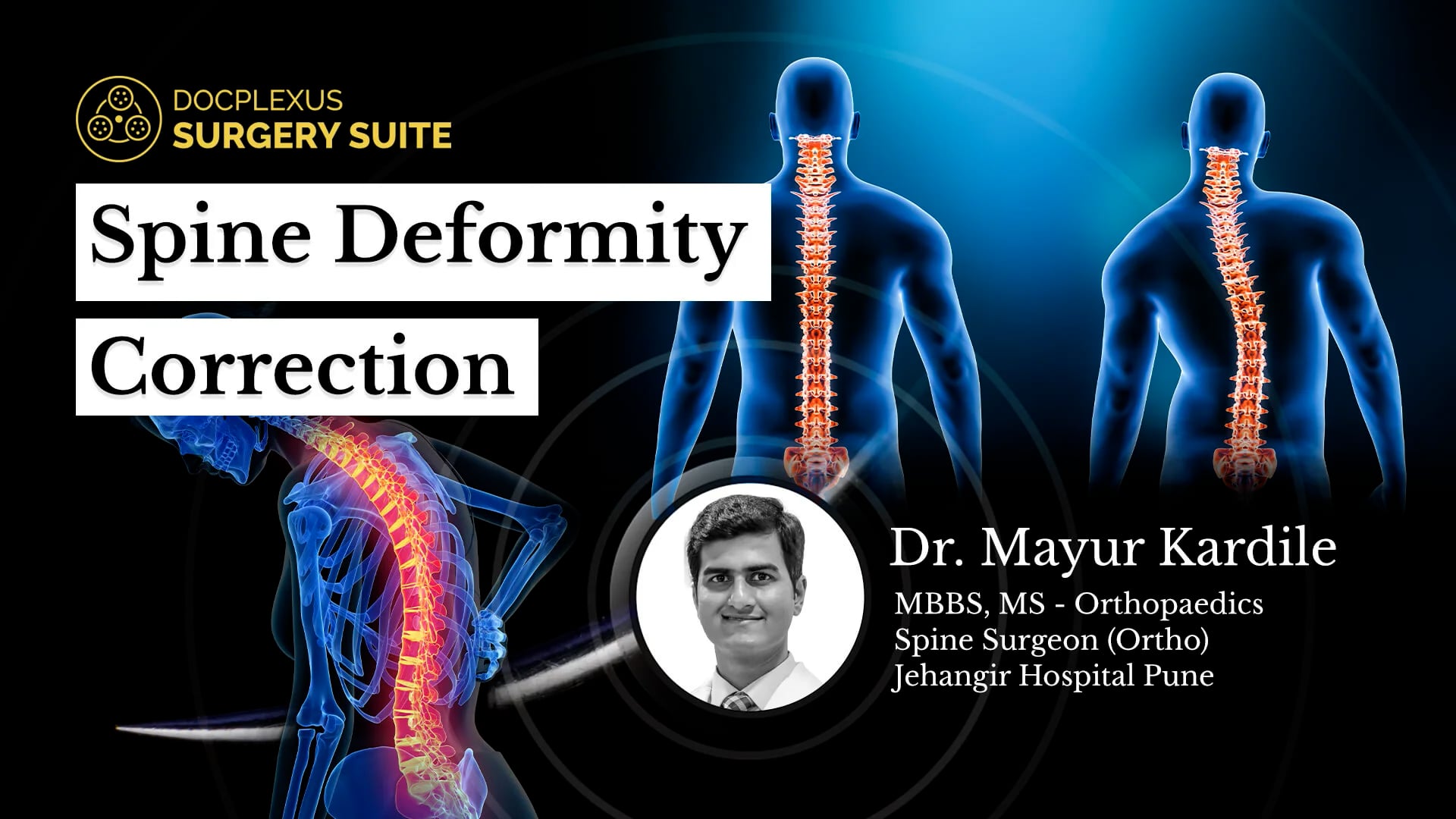 Spine Deformity Correction