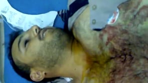 الشهيد الملازم أول أنس حمدوش القائد العسكري لكتيبة عمر بن عبد العزيز في حلب