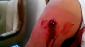 تفريق مظاهرة وسقوط جريح برصاص الأمن في صلاح الدين في محافظة حلب في  جمعة أبطال جامعة حلب