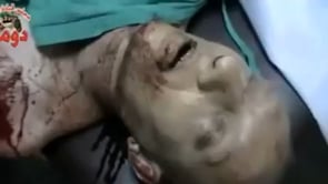 جثمان أحد ضحايا المجزرة في مدينة دوما في محافظة ريف دمشق