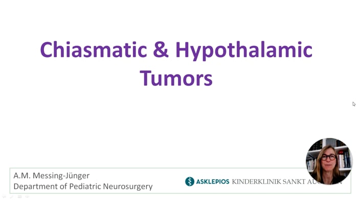 Chiasmatic & Hypothalamic Tumors