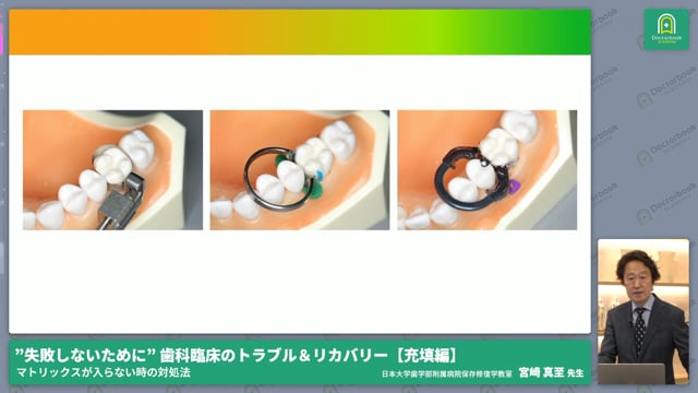 これで解決！！マトリックスが上手く入れられない時の対処法